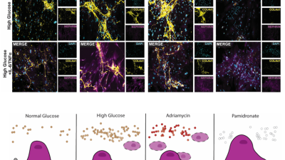 A new research publication from the Musah Lab leveraged human stem cell-derived models to uncover the complex molecular and cellular mechanisms underlying diabetic nephropathy